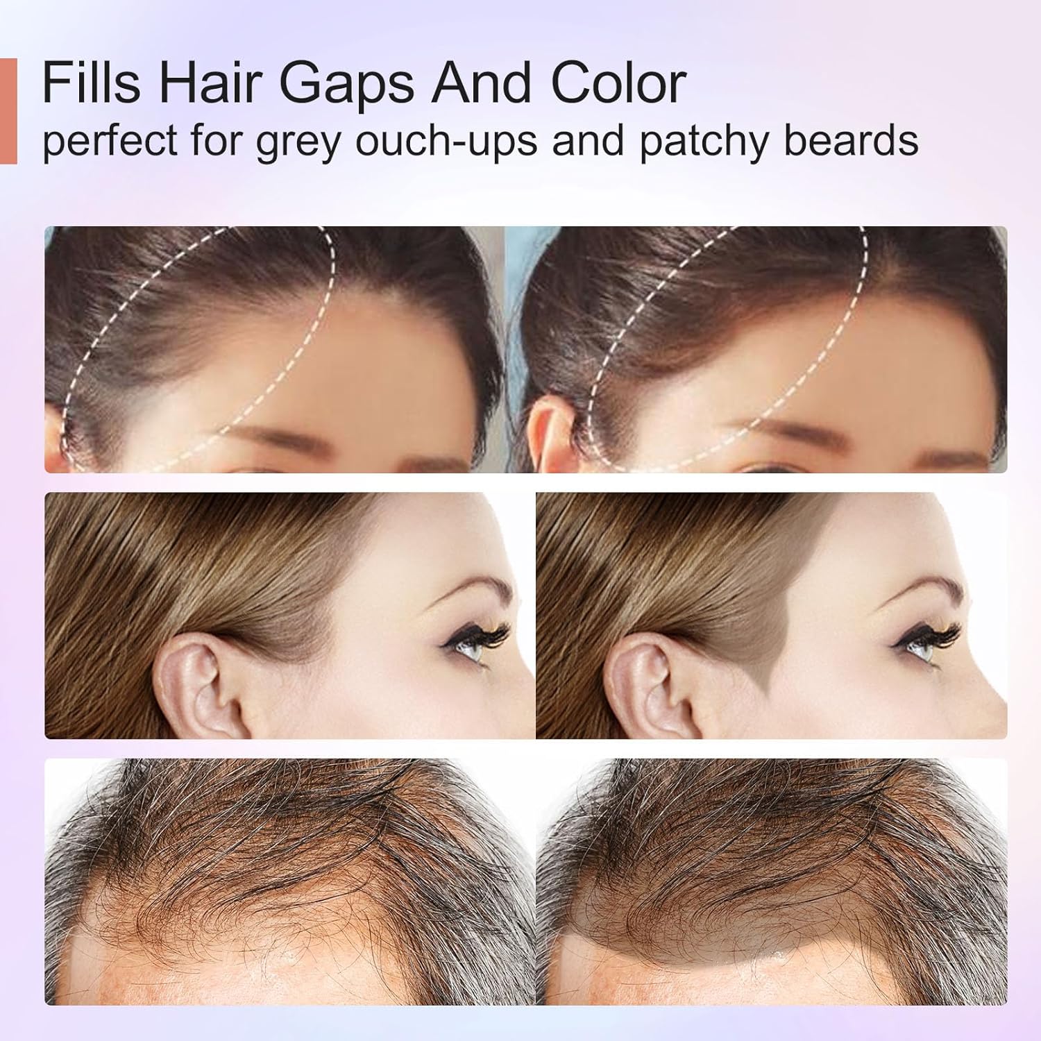 Acomler Instantly Root Cover Up Hairline Shadow Powder,Root Touch Up Hair Color Powder,Medium Blonde for Thinning Hair, Grey Hair Coverage for Women Men with Eyebrow, Beard Line, Bald Spot(Medium Blonde)